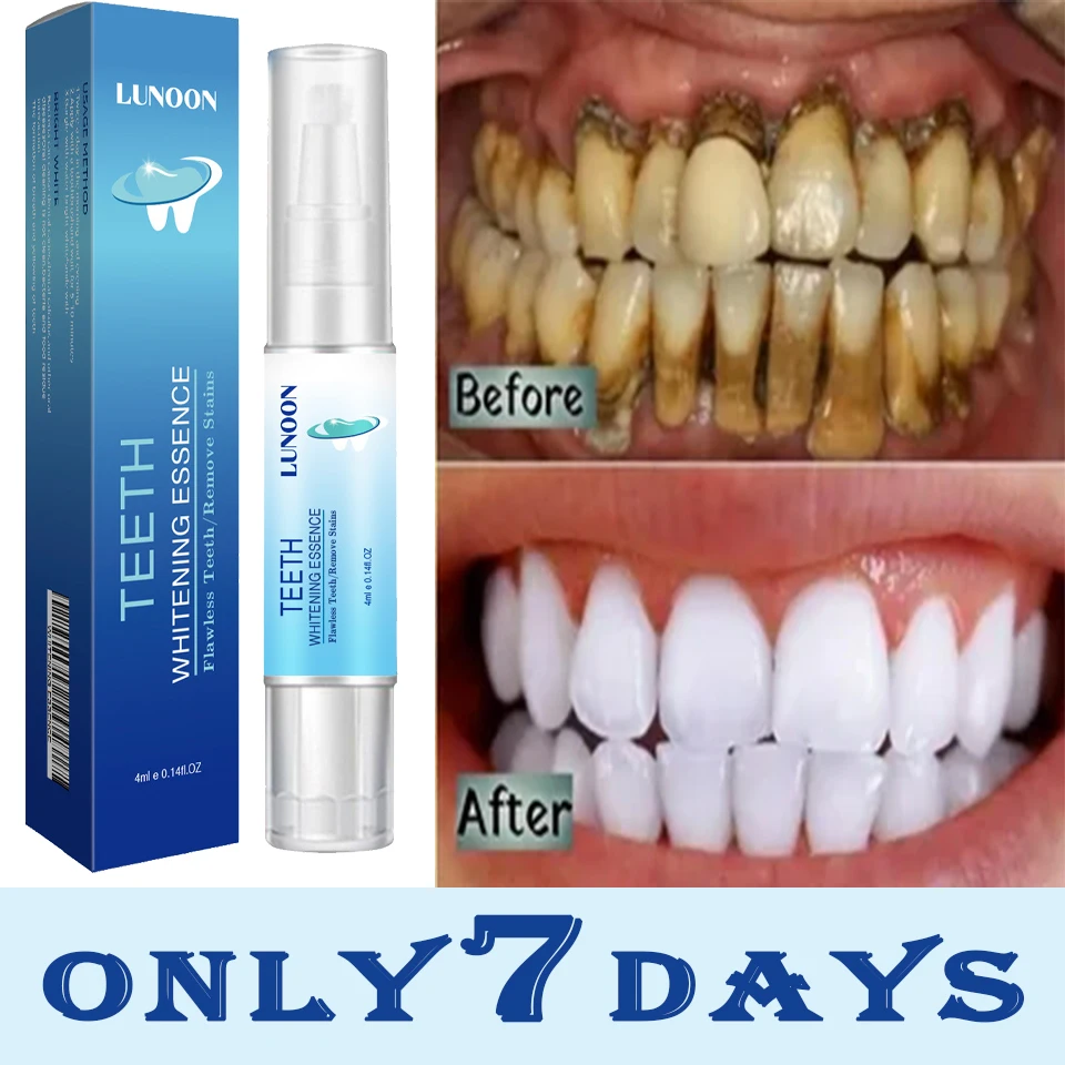 New Teeth Whitening Pen Tooth Gel Whitener Bleach Remove Stains Instant Smile Teeth Whitening Kit Cleaning Serum Beauty Health
New Teeth Whitening Pen Tooth Gel Whitener Bleach Remove Stains Instant Smile Teeth Whitening Kit Cleaning Serum Beauty Health