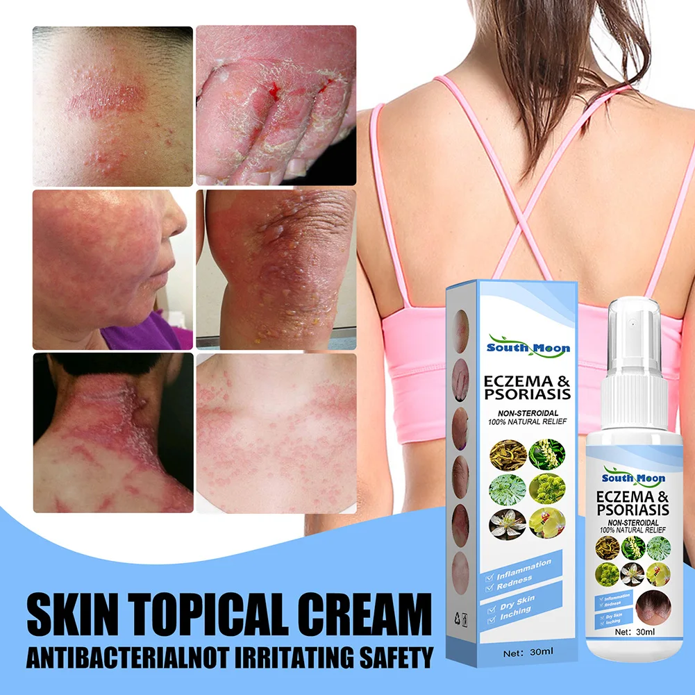 30ml Skin Psoriasis Spray Natural Herb Eczema Treatment Spray Itch Relief Improve Redness Dermatitis Psoriasis Spray Health Care
30ml Skin Psoriasis Spray Natural Herb Eczema Treatment Spray Itch Relief Improve Redness Dermatitis Psoriasis Spray Health Care
