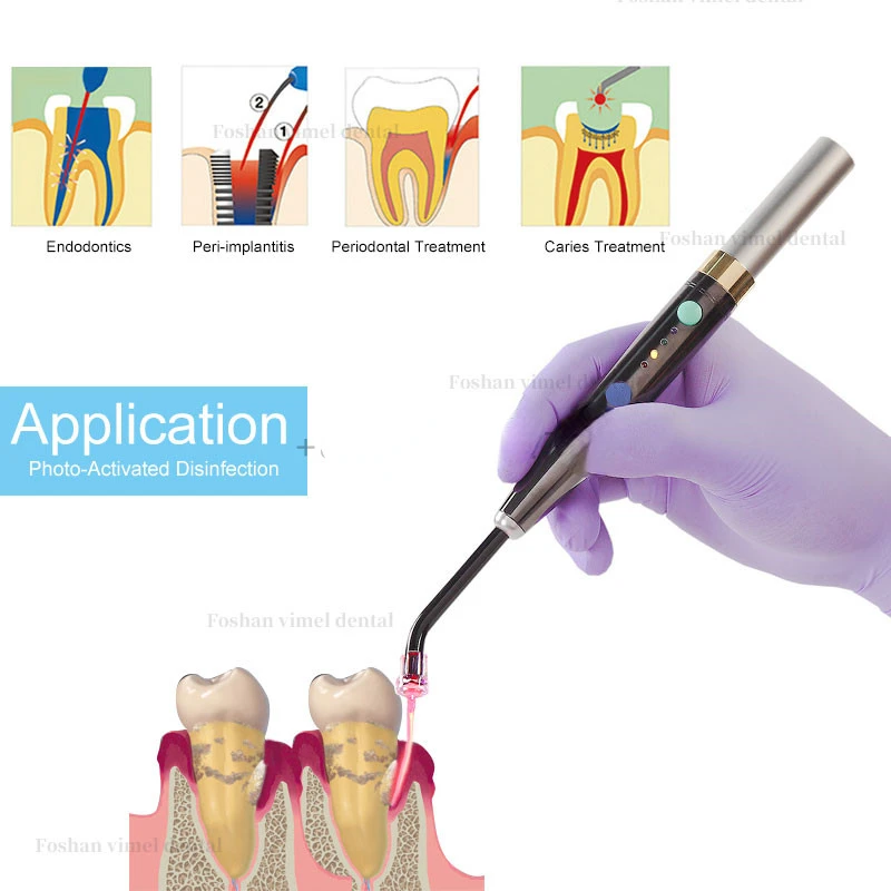 Dental Photo-Activated Disinfection F3WW PAD Light Low Level Oral Infrared Treatment Medical Equipment
Dental Photo-Activated Disinfection F3WW PAD Light Low Level Oral Infrared Treatment Medical Equipment