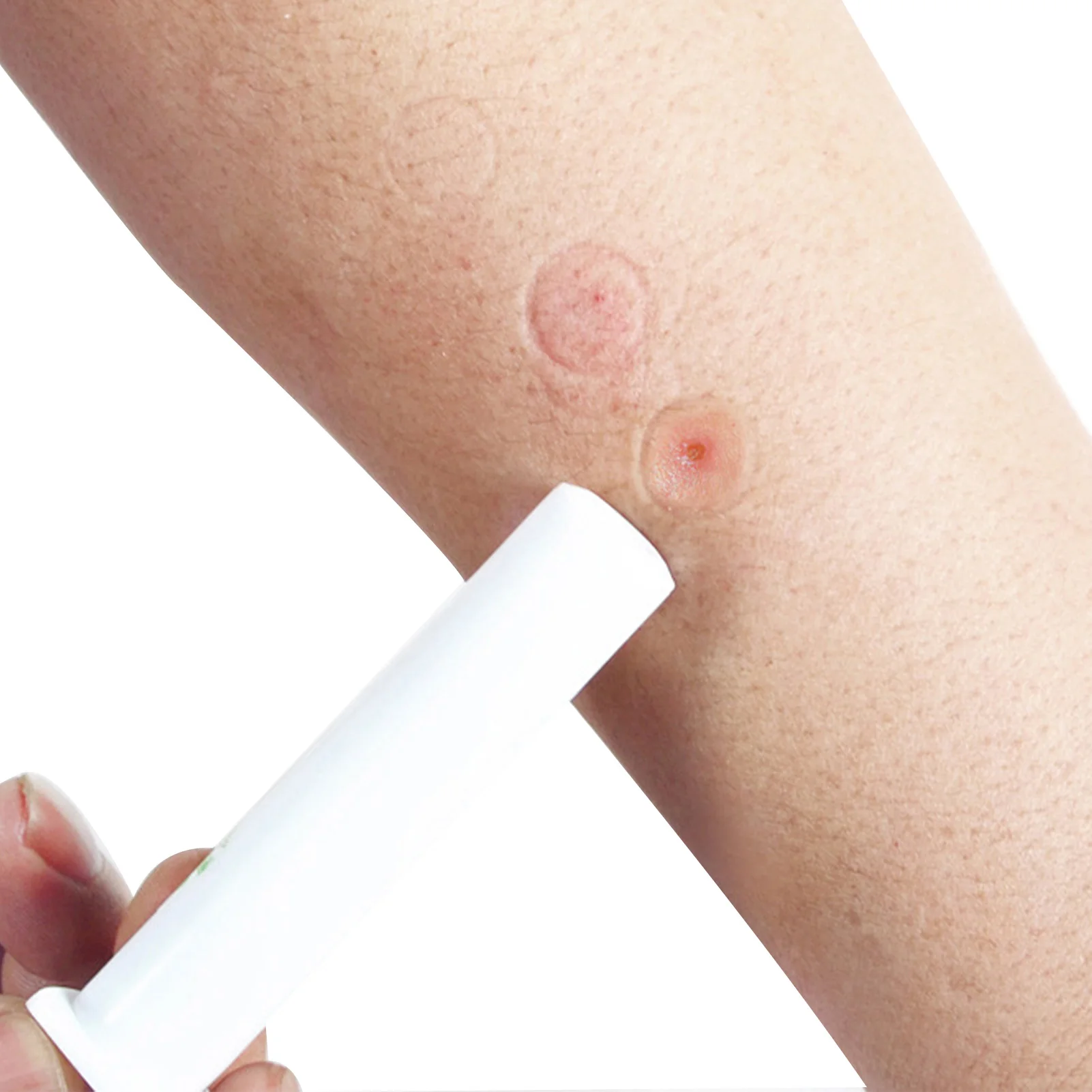 1 шт., вакуумный насос для удаления зуда и разбухания
1 шт., вакуумный насос для удаления зуда и разбухания