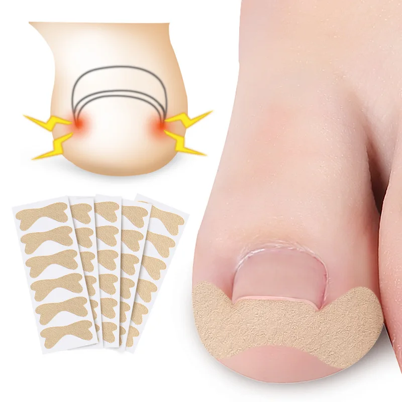6pcs/sheet Nail Correction Stickers Ingrown Toenail Corrector Patches Paronychia Treatment Recover Corrector Pedicure Tools
6pcs/sheet Nail Correction Stickers Ingrown Toenail Corrector Patches Paronychia Treatment Recover Corrector Pedicure Tools