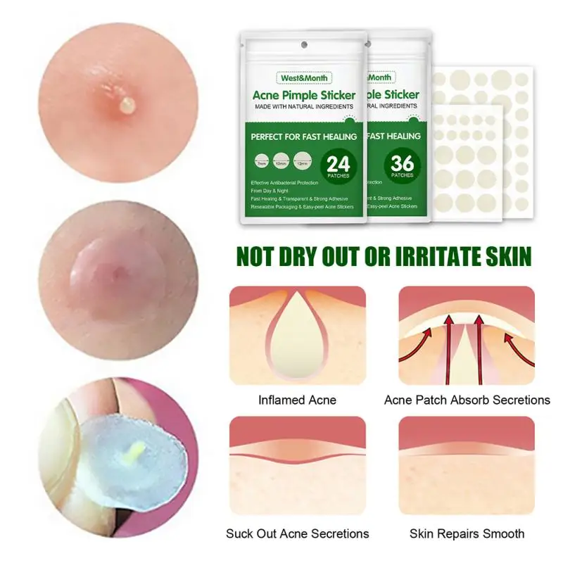 24/36 Pcs Acne Pimple Patch Invisible Stickers Acne Treatment Pimple Remover Tool Invisible Breathable Acne Patches Skin Care
24/36 Pcs Acne Pimple Patch Invisible Stickers Acne Treatment Pimple Remover Tool Invisible Breathable Acne Patches Skin Care