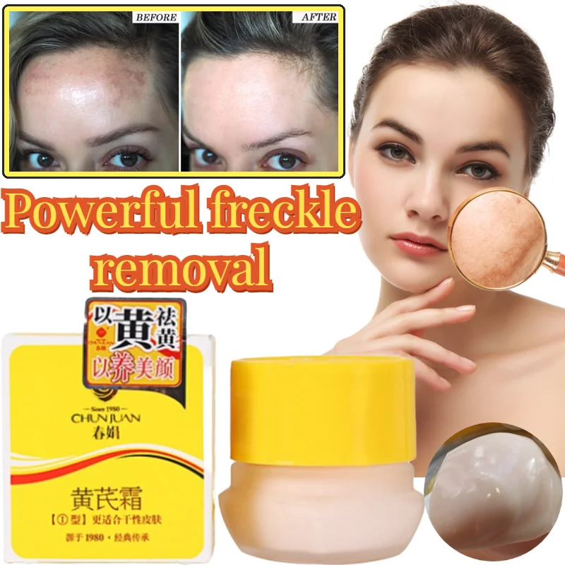 

Chinese Medicine Astragalus 20% Whitening Remove Dark Spots Facial Cream Repair Fade Freckls Melanin Remover Brighten Skin