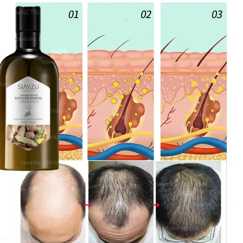 400ml Africa Women Traction Alopecia Treatment Hair Growth Product for Men Shampoo Hair Loss Treatment Get Rid of Wigs
400ml Africa Women Traction Alopecia Treatment Hair Growth Product for Men Shampoo Hair Loss Treatment Get Rid of Wigs