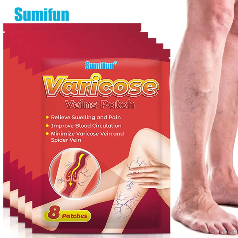 8/24/40pcs Sumifun Varicose Veins Plaster Vasculitis Phlebitis Spider Patch Varicosity Angiitis Removal Leg Care Herbal Plaster
8/24/40pcs Sumifun Varicose Veins Plaster Vasculitis Phlebitis Spider Patch Varicosity Angiitis Removal Leg Care Herbal Plaster