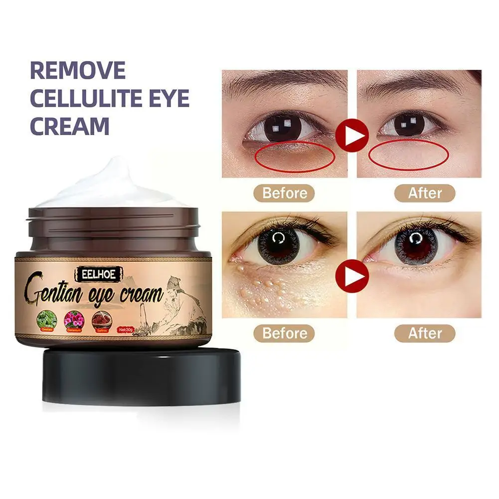 Anti-Wrinkle Eye Cream Remove Dark Circles Eye Bags Eye Fatty Product Korean Skin Serum Care Relieving Grains Anti-Aging Fi O8M6
Anti-Wrinkle Eye Cream Remove Dark Circles Eye Bags Eye Fatty Product Korean Skin Serum Care Relieving Grains Anti-Aging Fi O8M6