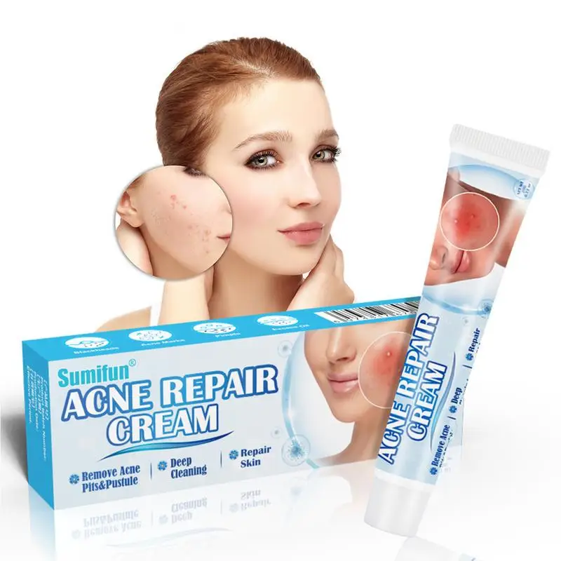 Herbal Chinese Medicine Acnes Cream Safe Gentle Acnes Removal Cream For Clearing Severe Scar Face Body Treatments Men Women
Herbal Chinese Medicine Acnes Cream Safe Gentle Acnes Removal Cream For Clearing Severe Scar Face Body Treatments Men Women