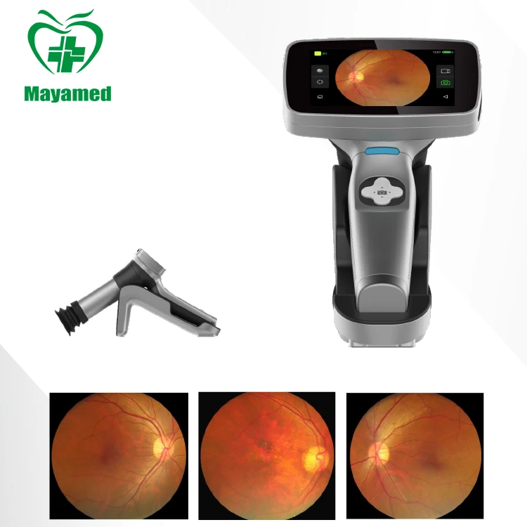 Intelligent and advanced MY-V038-N Handheld Digital HD imaging Portable Eye Fundus Camera
Intelligent and advanced MY-V038-N Handheld Digital HD imaging Portable Eye Fundus Camera