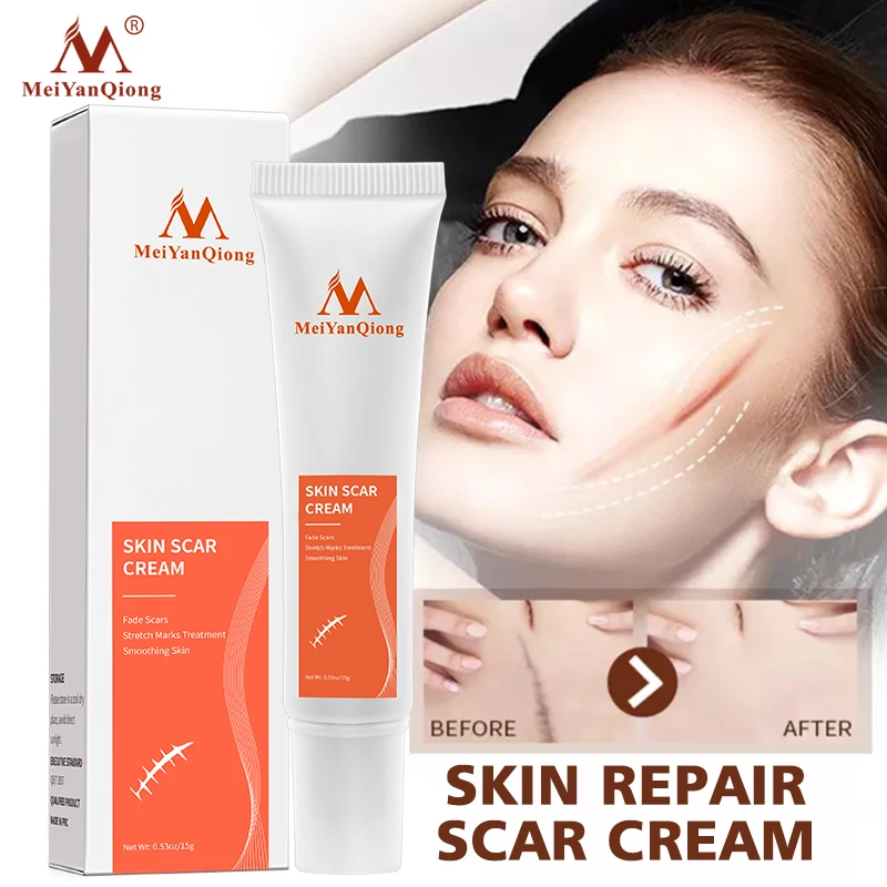 15g Skin Scar Cream Burn Old Scar Mark Smoothing Ointment Repair Whitening Pimples Face Gel Burn Surgical Remover Healthy Care
15g Skin Scar Cream Burn Old Scar Mark Smoothing Ointment Repair Whitening Pimples Face Gel Burn Surgical Remover Healthy Care