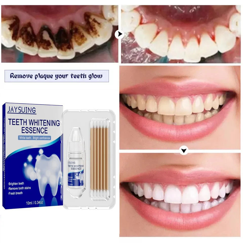 

Teeth Whitening Kit Bleach Essence Serum Oral Hygiene Clean Remove Plaque Stains Fresh Breath Dentistry Dental Tools Toothpaste