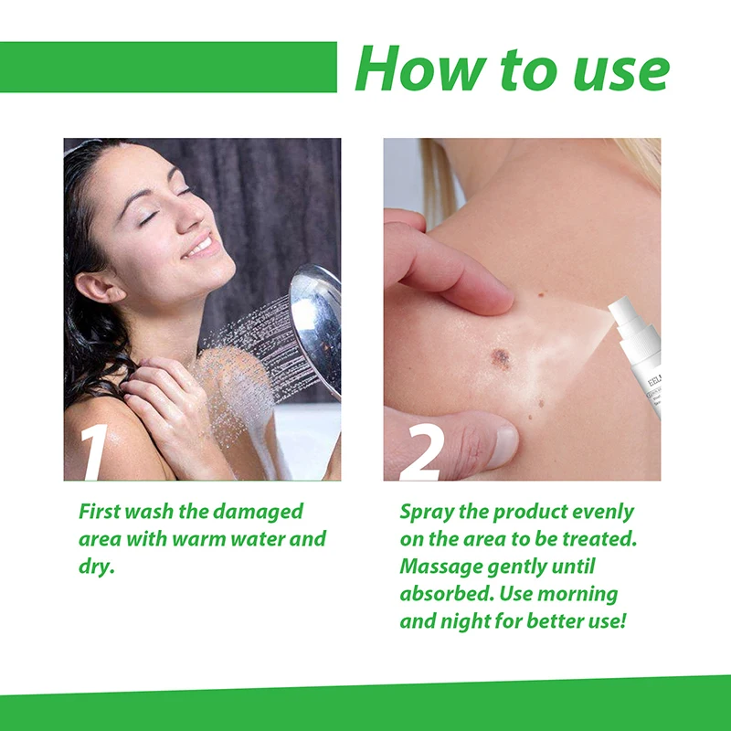 Evus жидкость для снятия макияжа 20 мл Многоцелевой крем для удаления бородавок, уход за телом, восстанавливающий крем
Evus жидкость для снятия макияжа 20 мл Многоцелевой крем для удаления бородавок, уход за телом, восстанавливающий крем