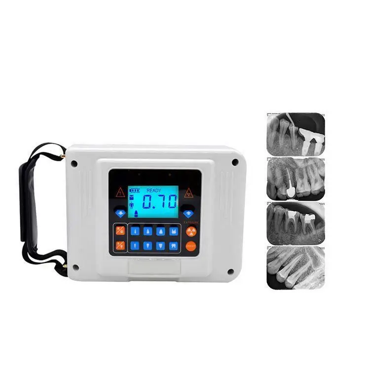 2D Blu Home Theater System Sensor Wireless Digital Portable Dental X Ray Machine For Pet Hospital
2D Blu Home Theater System Sensor Wireless Digital Portable Dental X Ray Machine For Pet Hospital