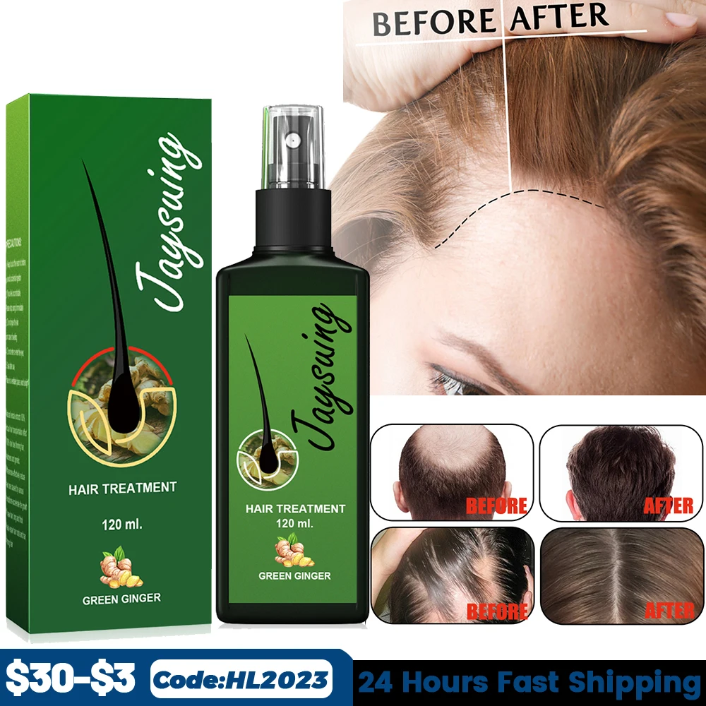 Ginger Hair Growth Spray Serum Anti Hair Loss Fast Grow Hair Essential Oil Treatments Dry Damaged Thinning Hair Care Products
Ginger Hair Growth Spray Serum Anti Hair Loss Fast Grow Hair Essential Oil Treatments Dry Damaged Thinning Hair Care Products