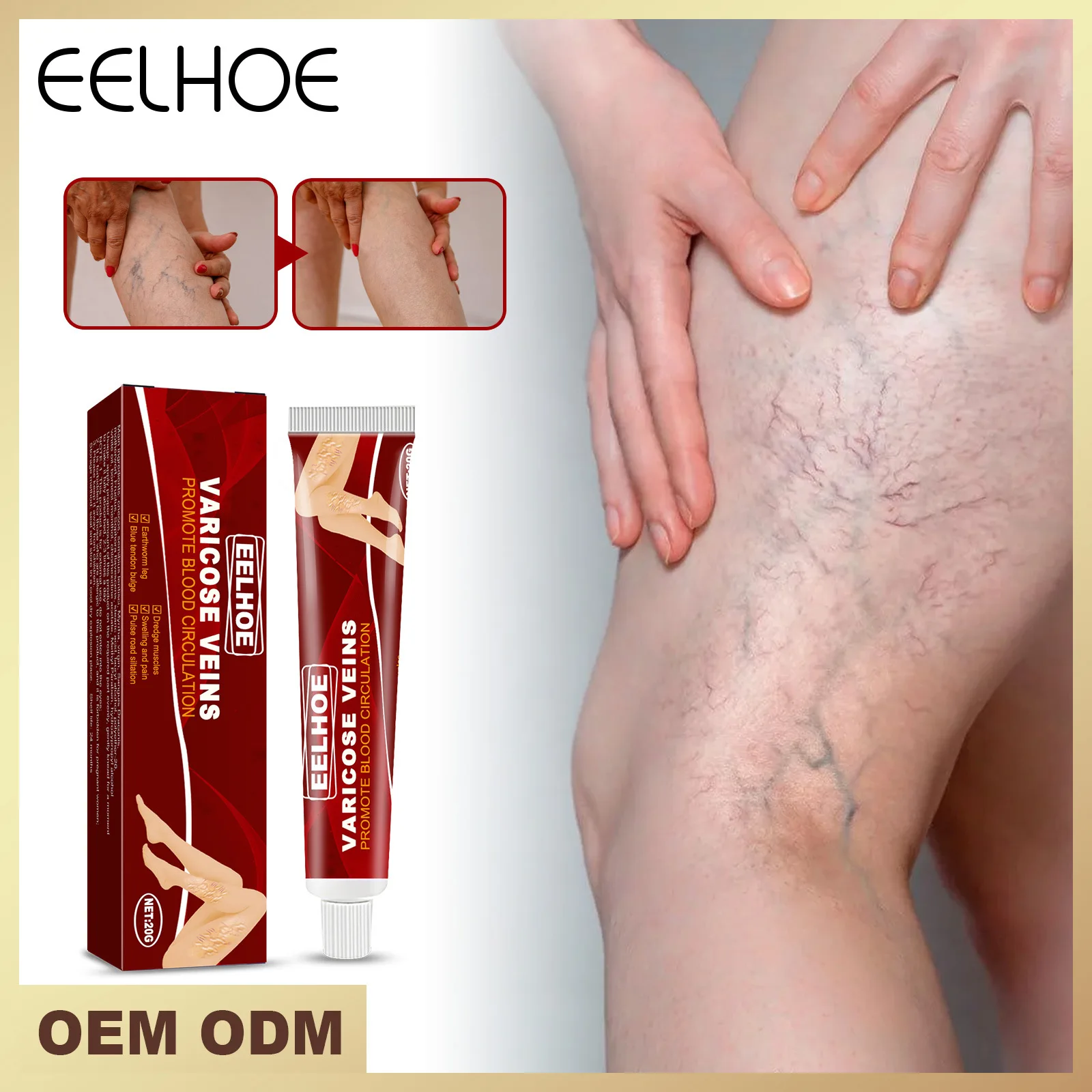 Varicose Veins Relief Cream Vasculitis Phlebitis Spider Leg Worm Leg Relieve Itching Pain Ointment Medical Plaster Body Care
Varicose Veins Relief Cream Vasculitis Phlebitis Spider Leg Worm Leg Relieve Itching Pain Ointment Medical Plaster Body Care