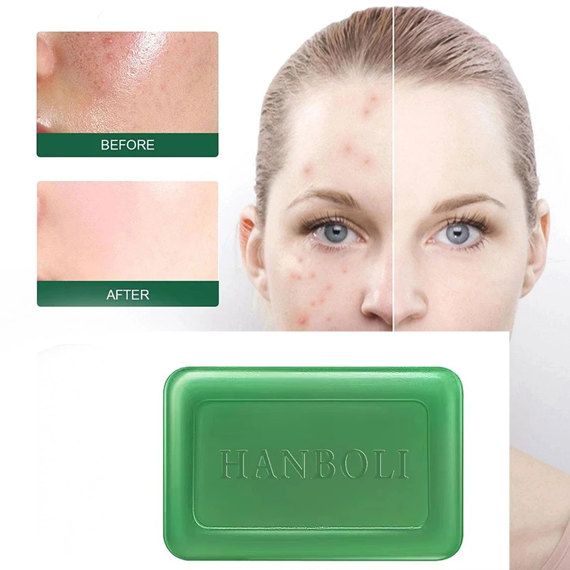 Wormwood Anti-Itching Essential Oil Soap Skin Itching Sterilization Anti-Acne Anti-Mite Artifact Family Cleaning Handmade Soap
Wormwood Anti-Itching Essential Oil Soap Skin Itching Sterilization Anti-Acne Anti-Mite Artifact Family Cleaning Handmade Soap