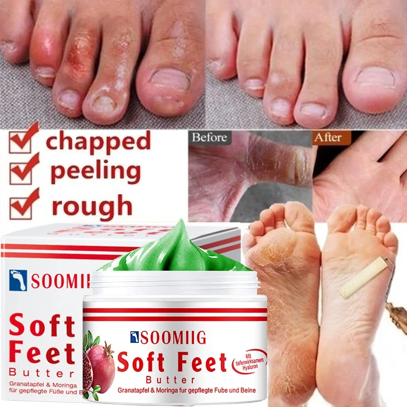 Soomiig Anti-dry and Cracked Foot Hand Cream Heel Crack Repair Hand and Foot Mask Moisturizing Whitening Exfoliating Skin Care
Soomiig Anti-dry and Cracked Foot Hand Cream Heel Crack Repair Hand and Foot Mask Moisturizing Whitening Exfoliating Skin Care