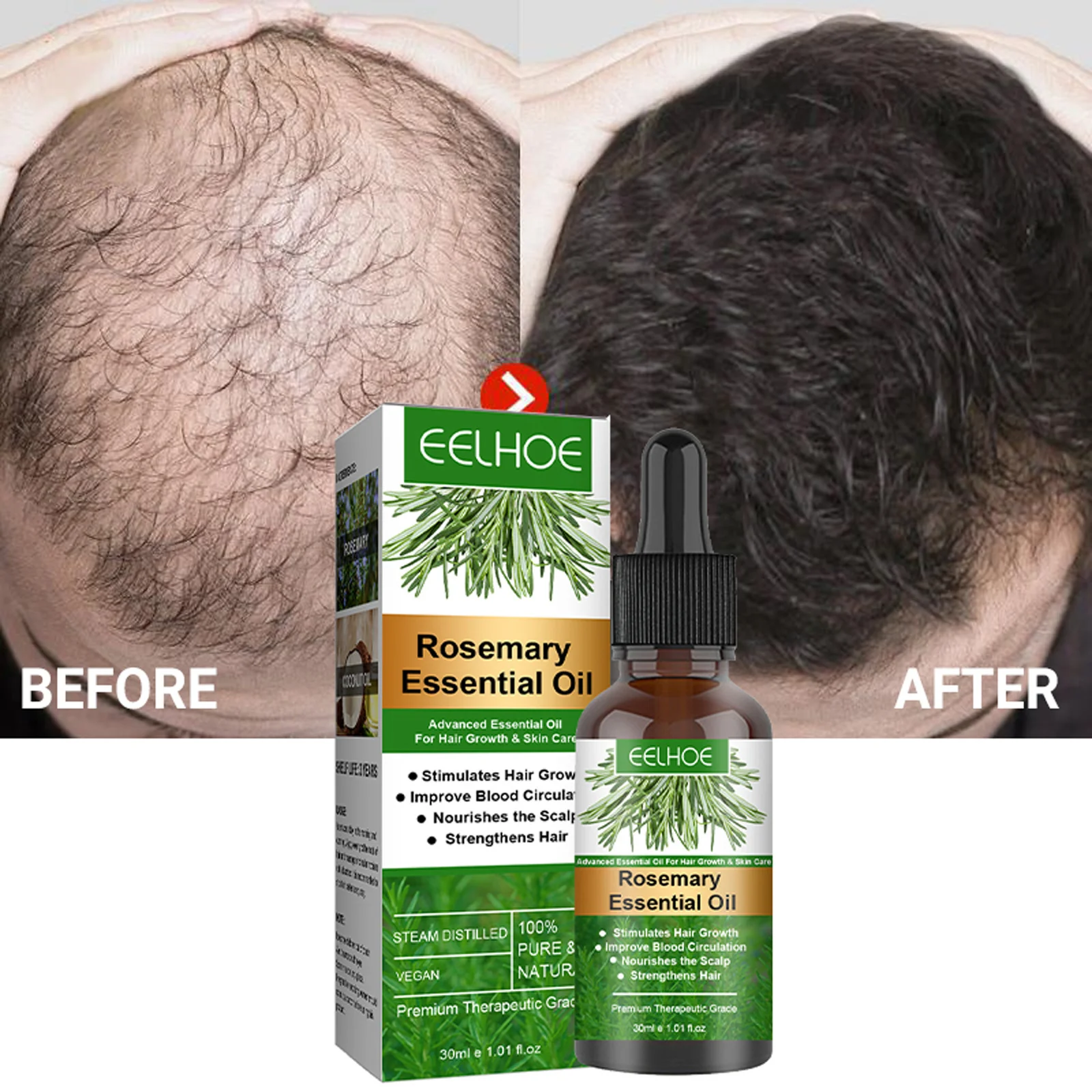 Rosemary Hair Growth Products Anti Hair Loss Essential Oil Fast Regrowth Prevent Baldness Scalp Treatment Beauty Hair Care 30ml
Rosemary Hair Growth Products Anti Hair Loss Essential Oil Fast Regrowth Prevent Baldness Scalp Treatment Beauty Hair Care 30ml
