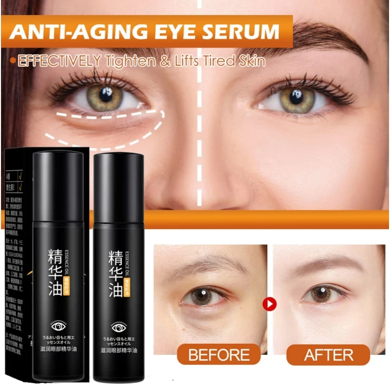 Retinol Anti-Wrinkle Eye Serum Oil Squalane Lifts Tightens Eye Area Lightens Fine Lines Dark Circles Remove Eyes Bags Puffiness
Retinol Anti-Wrinkle Eye Serum Oil Squalane Lifts Tightens Eye Area Lightens Fine Lines Dark Circles Remove Eyes Bags Puffiness
