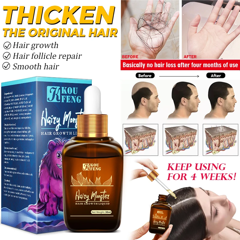 KouFeng Hair Growth Essential Oil 30ML Hair Fast Growing Products Hair Regrowth Prevent Hair Loss Beauty Hair Care For Men Women
KouFeng Hair Growth Essential Oil 30ML Hair Fast Growing Products Hair Regrowth Prevent Hair Loss Beauty Hair Care For Men Women