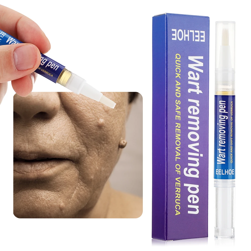 Warts Removal Pen Eliminate Wart Pen Wart Liquid Hand Foot Warts Remove Filiform Warts Flat Warts Condyloma Acuminatum 5ml
Warts Removal Pen Eliminate Wart Pen Wart Liquid Hand Foot Warts Remove Filiform Warts Flat Warts Condyloma Acuminatum 5ml