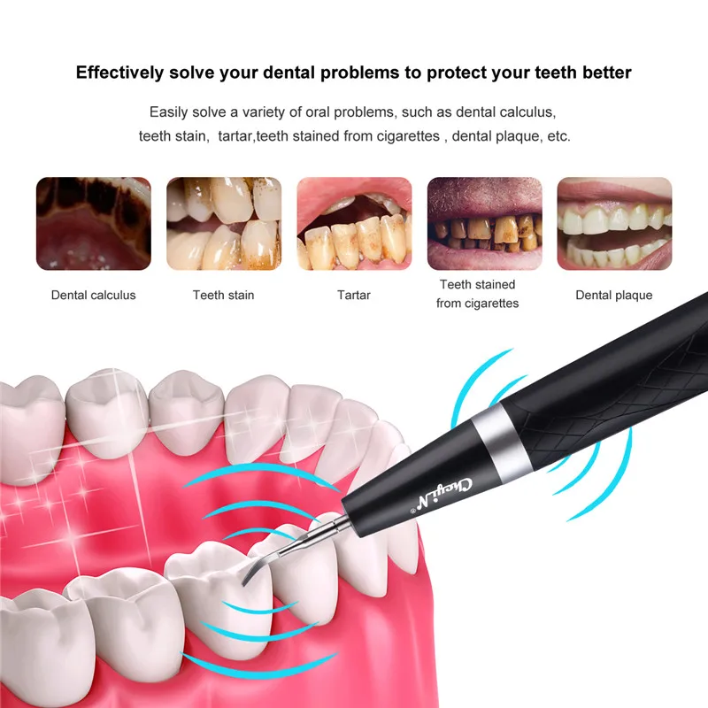 Usb Ultrasonic High-Frequency Vibration Ion Dental Scaler Dental Calculus Remover Multiple Modes Teeth Whitening Tools
Usb Ultrasonic High-Frequency Vibration Ion Dental Scaler Dental Calculus Remover Multiple Modes Teeth Whitening Tools
