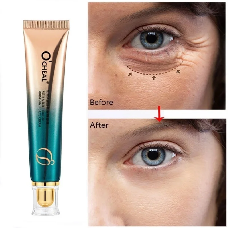 Anti-Wrinkle Eye Cream Dark Circles Eye Bags Remover Serum Fade Fine Lines Anti-Aging Puffiness Firming Lift Brighten Skin Care
Anti-Wrinkle Eye Cream Dark Circles Eye Bags Remover Serum Fade Fine Lines Anti-Aging Puffiness Firming Lift Brighten Skin Care