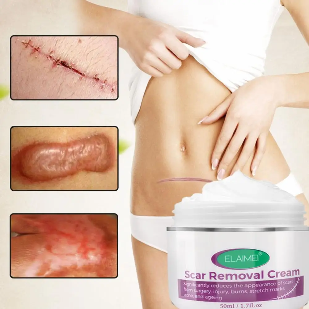 Effective Skin Repair Treatment ELAIMEI Skin Rebound Scarless Cream Scar Removal Stretch Marks Wounds
Effective Skin Repair Treatment ELAIMEI Skin Rebound Scarless Cream Scar Removal Stretch Marks Wounds