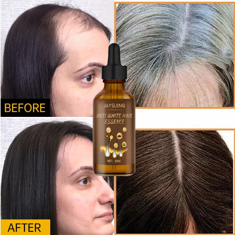 30ml Fast Anti-White Hair Serum Repair Nourish Damaged Scalp Regrowth Prevent Baldness Gray Beard Treatment Care Beauty Health
30ml Fast Anti-White Hair Serum Repair Nourish Damaged Scalp Regrowth Prevent Baldness Gray Beard Treatment Care Beauty Health