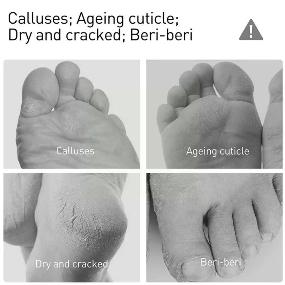 Japan Cosmetics Foot Peeling Spray Natural Orange Essence Foot Mask Pedicure Tool Care Dead Skin Hands Whiten Exfoliator Ba H1Z4
Japan Cosmetics Foot Peeling Spray Natural Orange Essence Foot Mask Pedicure Tool Care Dead Skin Hands Whiten Exfoliator Ba H1Z4