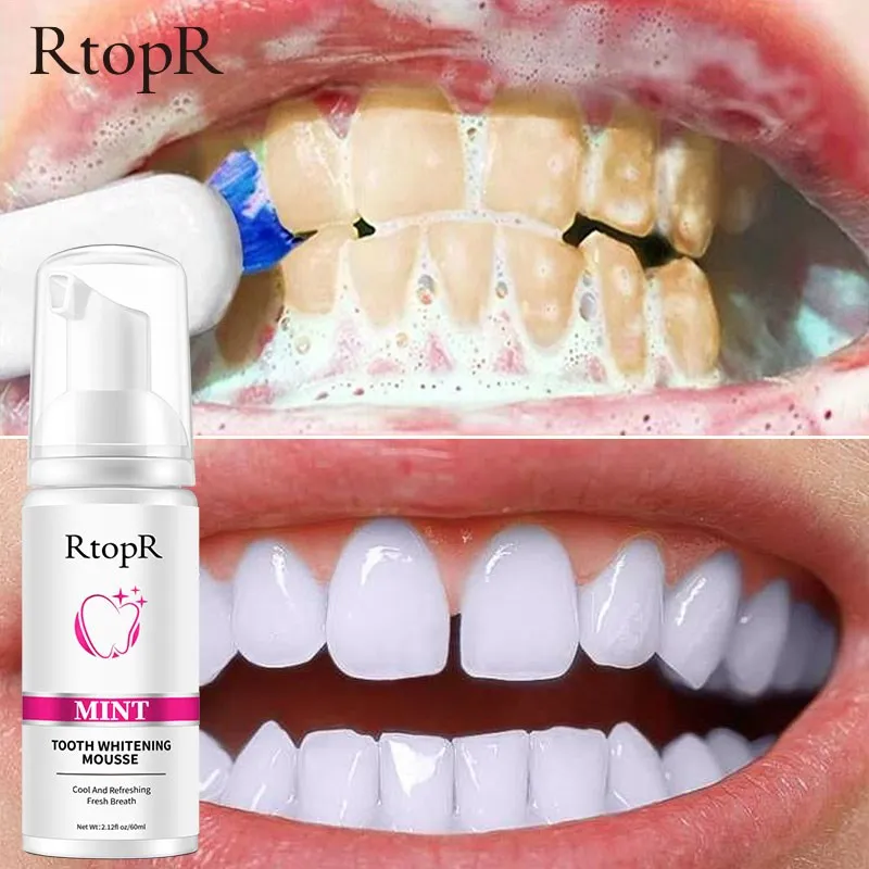 RtopR Mint Tooth Whitenging Mousse Oral Cleaning Whitening Teeth Plaque Stains Removal Remove Odor Oral Refreshing Whiten Teeth
RtopR Mint Tooth Whitenging Mousse Oral Cleaning Whitening Teeth Plaque Stains Removal Remove Odor Oral Refreshing Whiten Teeth
