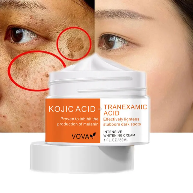 Intensive Whitening Cream Removal Melasma Acne Spot Remove Dark Spots Anti Freckle Fade Melanin Brighten Whiten Skin Care 30ml
Intensive Whitening Cream Removal Melasma Acne Spot Remove Dark Spots Anti Freckle Fade Melanin Brighten Whiten Skin Care 30ml