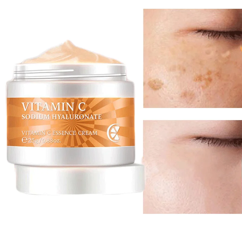 

Vitamin C Whitening Freckle Cream Instant Remove Face Melasma Dark Spot Melanin Moisturizer Anti-aging Brighten Beauty Skin Care
