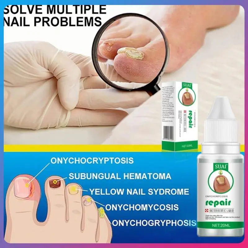 SUAI Nail Repair Liquid Anti-fungal Remove Onychomycosis Quickly Penetrate Fluid Serum For Foot Nails Care Manicure Care
SUAI Nail Repair Liquid Anti-fungal Remove Onychomycosis Quickly Penetrate Fluid Serum For Foot Nails Care Manicure Care