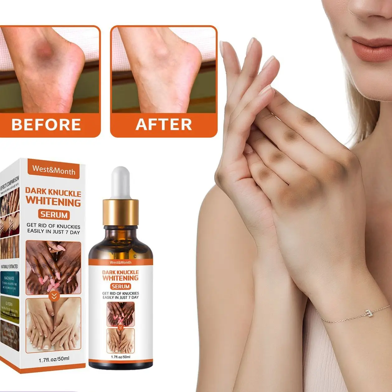 50g Joint Blackening And Beautifying Skin Care Solution Knee And Ankle Corners Brighten Skin Tone Moisturize Melanin
50g Joint Blackening And Beautifying Skin Care Solution Knee And Ankle Corners Brighten Skin Tone Moisturize Melanin
