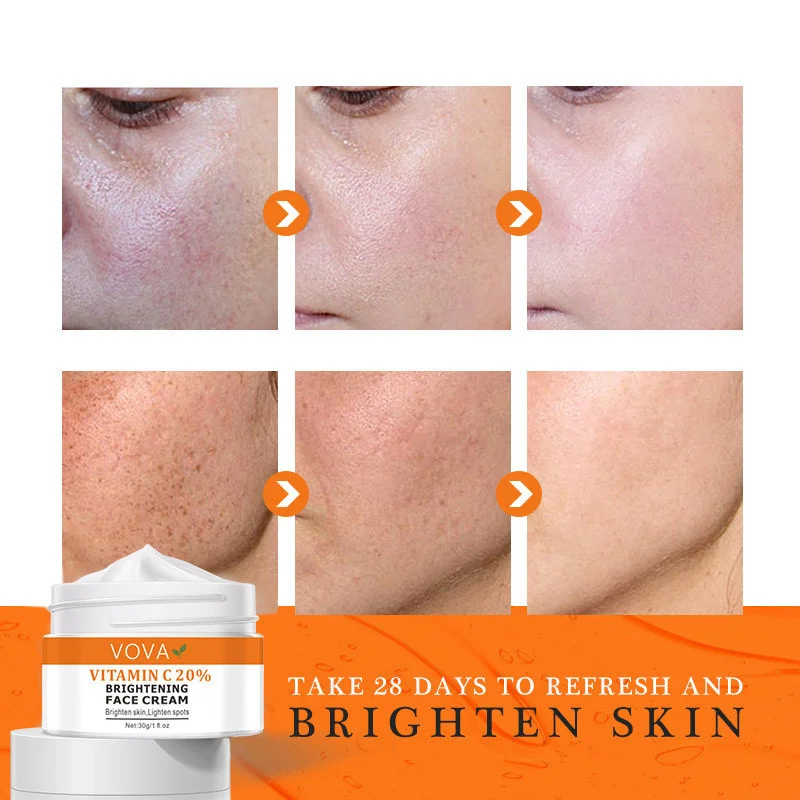 VOVA Vitamin C 20% Freckle Whitening Facial Cream Remove Dark Spots Lighten Dullness Melanin Pigmentation Brighten Skin Care
VOVA Vitamin C 20% Freckle Whitening Facial Cream Remove Dark Spots Lighten Dullness Melanin Pigmentation Brighten Skin Care