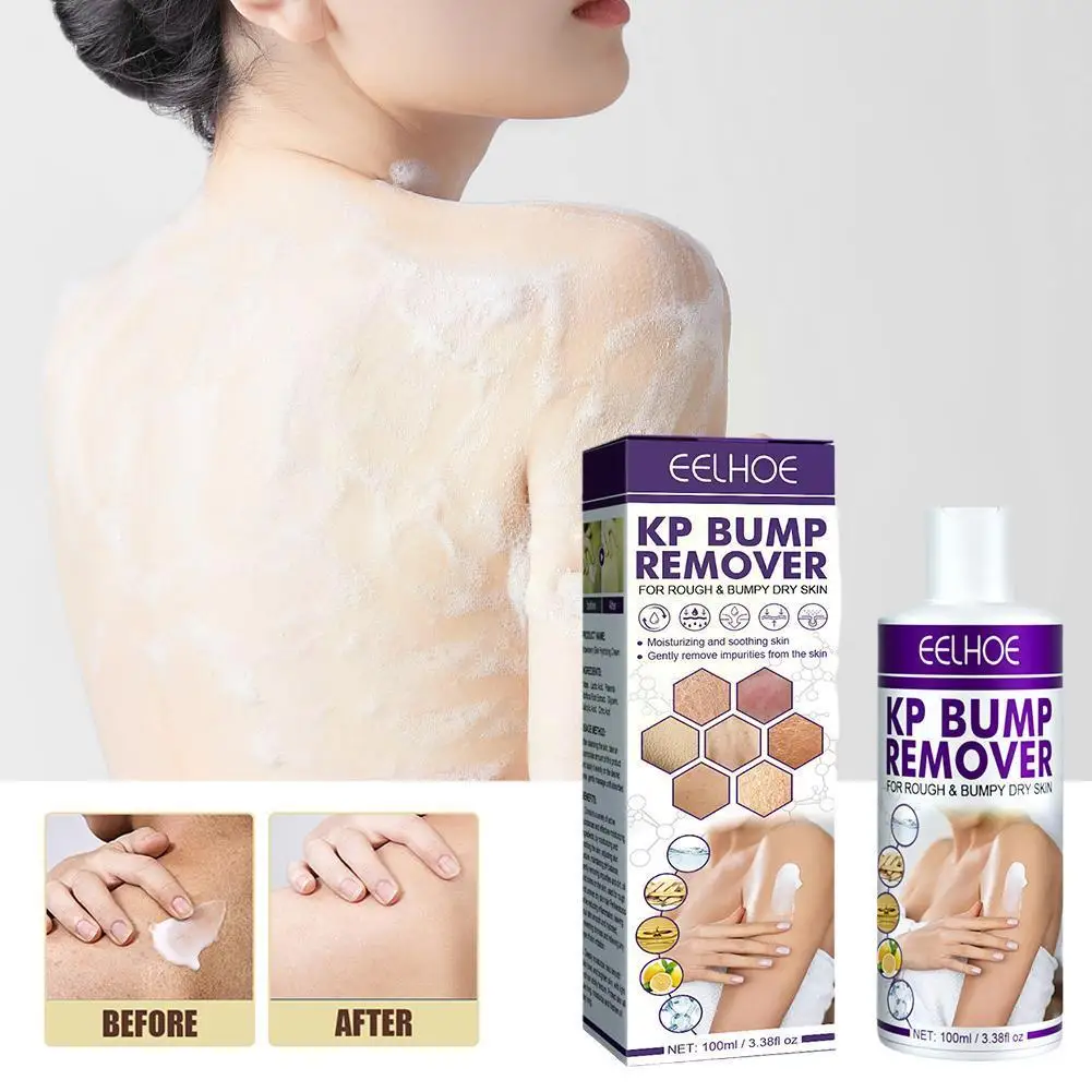100ml Removing Keratin Repair Cream Skin Treatment Body Whitening Moisturizing Cream Deep Lotion Softening Moisturizing J2G4
100ml Removing Keratin Repair Cream Skin Treatment Body Whitening Moisturizing Cream Deep Lotion Softening Moisturizing J2G4