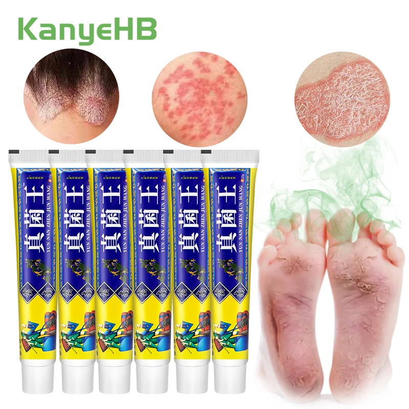 2-4-6pcs Psoriasis Eczema Cream Treatment Beriberi Dermatitis Relieve Itchy Skin Fungal Infection Herbal Cooling Medical Plaster
2-4-6pcs Psoriasis Eczema Cream Treatment Beriberi Dermatitis Relieve Itchy Skin Fungal Infection Herbal Cooling Medical Plaster