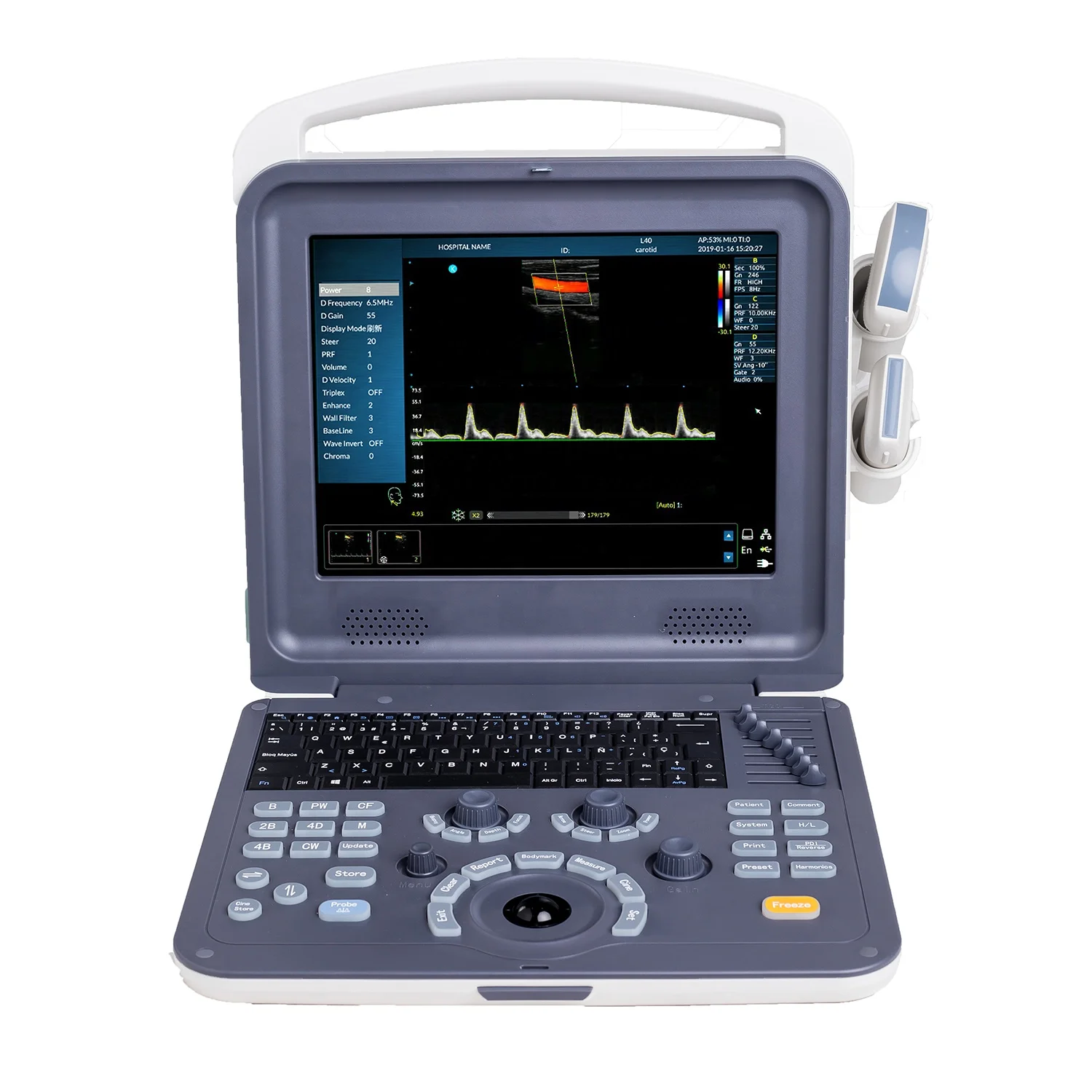 Portable Full Digital 3D 4D Diagnostic Scanner Color Doppler Ultrasound Machine for hospital use
Portable Full Digital 3D 4D Diagnostic Scanner Color Doppler Ultrasound Machine for hospital use