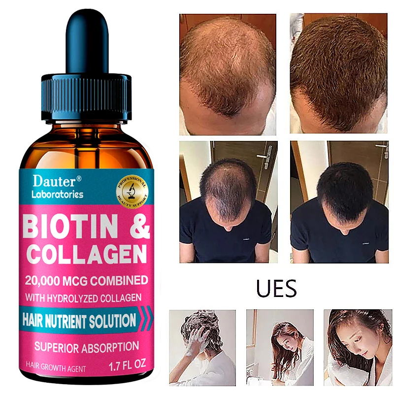 Rapid hair growth essential oil nourishes hair root scalp care repairs hair damage anti-hair loss hair care essence
Rapid hair growth essential oil nourishes hair root scalp care repairs hair damage anti-hair loss hair care essence