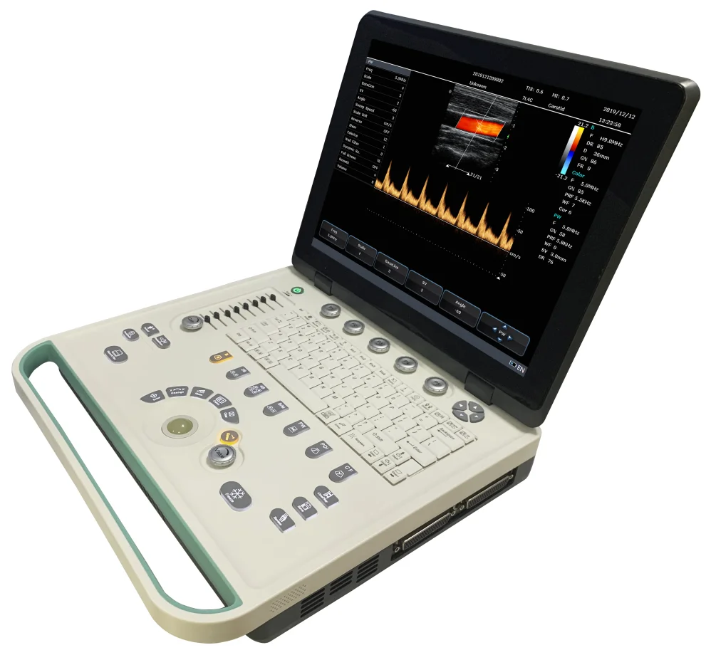 Medical ultrasound instruments Portable Color Doppler Digital Ultrasound Machine/ Doppler Ultrasonic Diagnostic Ultrasound
Medical ultrasound instruments Portable Color Doppler Digital Ultrasound Machine/ Doppler Ultrasonic Diagnostic Ultrasound
