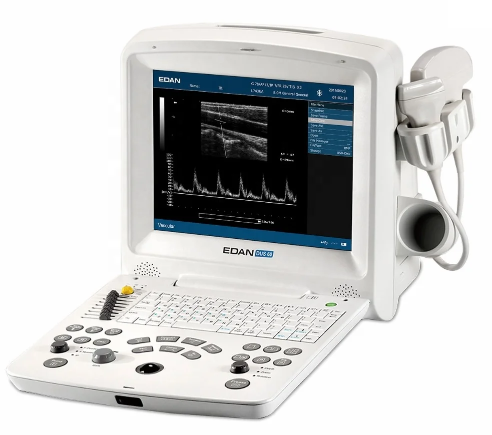 Advanced Edan DUS 60 VET цифровой ультразвуковой аппарат для Vet Portable
Advanced Edan DUS 60 VET цифровой ультразвуковой аппарат для Vet Portable