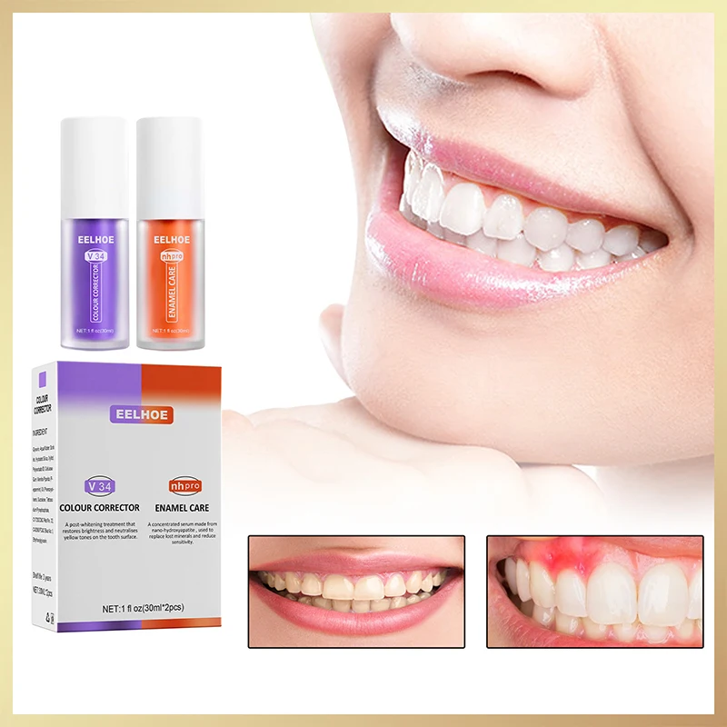 V34 Teeth Whitening Toothpaste Tooth Colour Corrector 30ml Enamel Care Toothpaste Intensive Stain Removal Reduce Yellowing
V34 Teeth Whitening Toothpaste Tooth Colour Corrector 30ml Enamel Care Toothpaste Intensive Stain Removal Reduce Yellowing