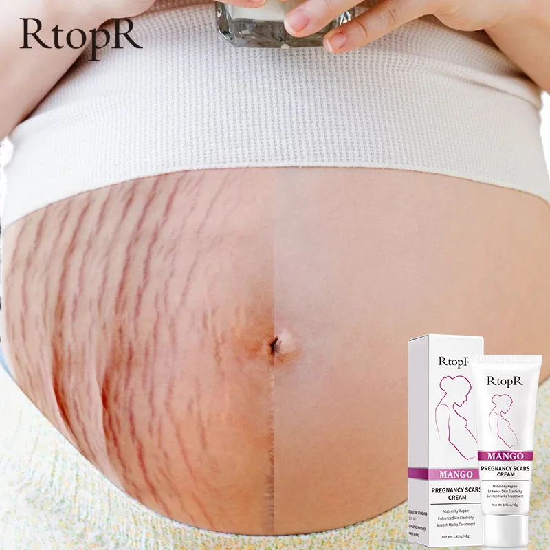 RtopR Pregnancy Scar Removal Cream Firming Repair Brightening Stretch Gel Pregnant Women Pigment Correction Body Care 1PCS
RtopR Pregnancy Scar Removal Cream Firming Repair Brightening Stretch Gel Pregnant Women Pigment Correction Body Care 1PCS