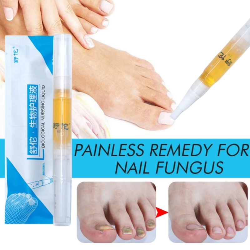 New Nail Fungus Treatments Oil Repair Toe Nail Fungal Removal Essence Anti-Infection Onychomycosis Paronychia Gel Hand Feet Care
New Nail Fungus Treatments Oil Repair Toe Nail Fungal Removal Essence Anti-Infection Onychomycosis Paronychia Gel Hand Feet Care