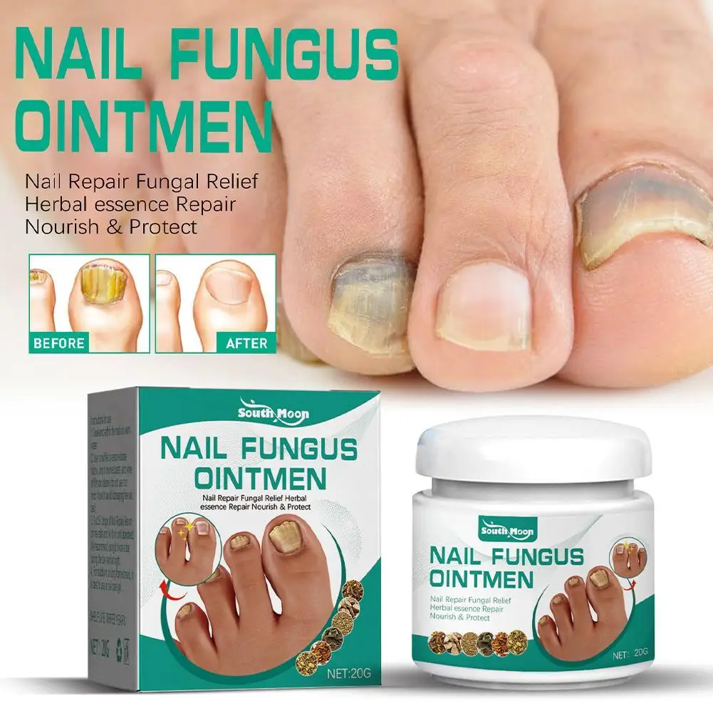 

Nail Fungus Treatment Very Stronger Removal Feet Care Cream Anti Infection Paronychia Onychomycosis Nail Foot Toe PowderProduct