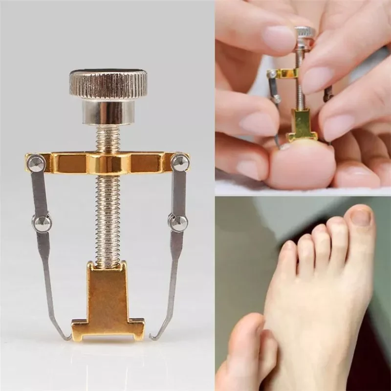 Ingrown Toenail Corrector Pedicure Toenail Fixer Foot Nail Care Orthotic Stainless Steel Treatment Onyxis Bunion Correction Tool
Ingrown Toenail Corrector Pedicure Toenail Fixer Foot Nail Care Orthotic Stainless Steel Treatment Onyxis Bunion Correction Tool