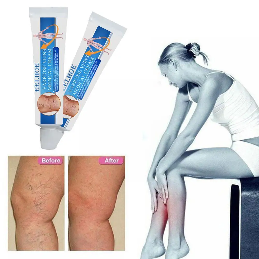 1pcs 16g Varicose Veins Treatment Cream Varicosity Relief Remedy Veins Crea Phlebitis Veins Legs Varicose Pain Ointment Ang W6v2
1pcs 16g Varicose Veins Treatment Cream Varicosity Relief Remedy Veins Crea Phlebitis Veins Legs Varicose Pain Ointment Ang W6v2