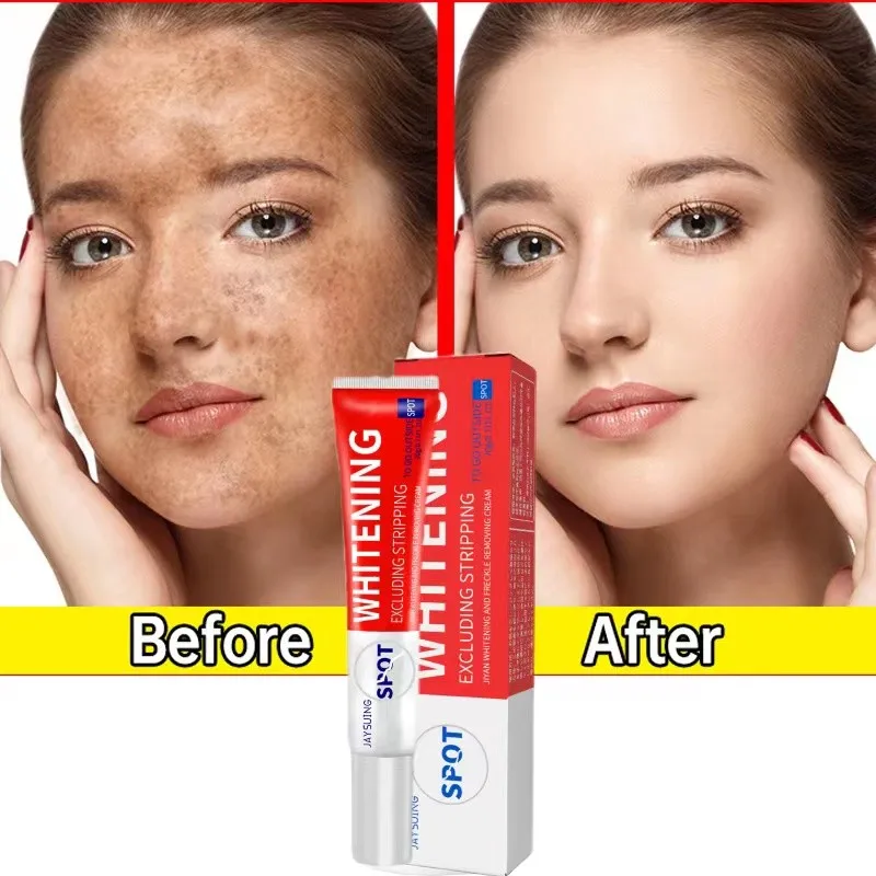 Effective Whitening Freckles Cream Remove Melasma Dark Spots Fade Melanin Brighten Nourish Anti-Aging Facial Skin Care 30ml
Effective Whitening Freckles Cream Remove Melasma Dark Spots Fade Melanin Brighten Nourish Anti-Aging Facial Skin Care 30ml