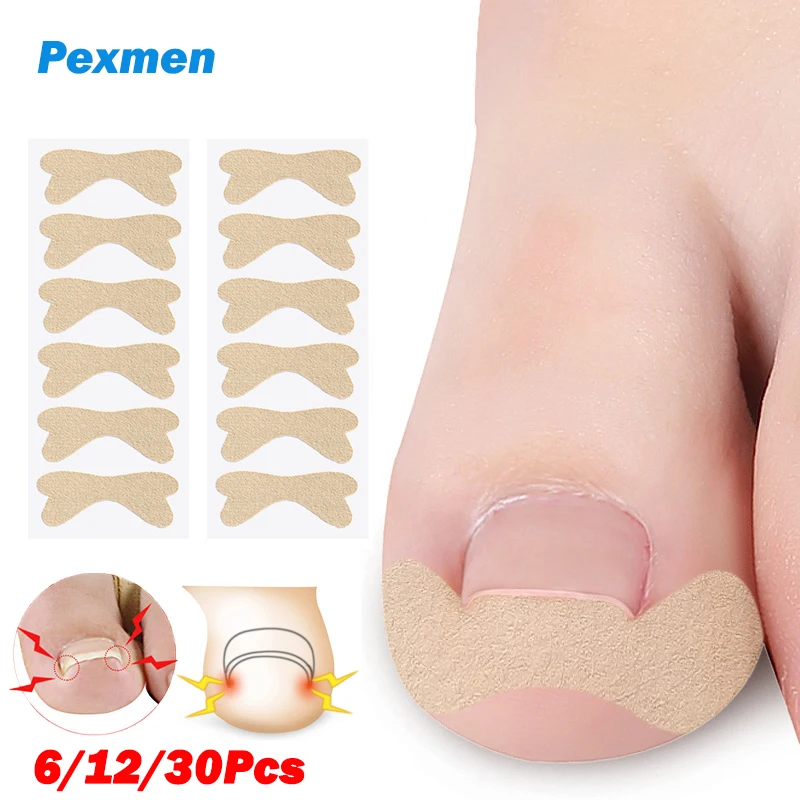 Pexmen 6/12/30Pcs Ingrown Toenail Correction Sticker Adhesive Toenail Patch Toe Nail Treatment Corrector Foot Care Tool
Pexmen 6/12/30Pcs Ingrown Toenail Correction Sticker Adhesive Toenail Patch Toe Nail Treatment Corrector Foot Care Tool