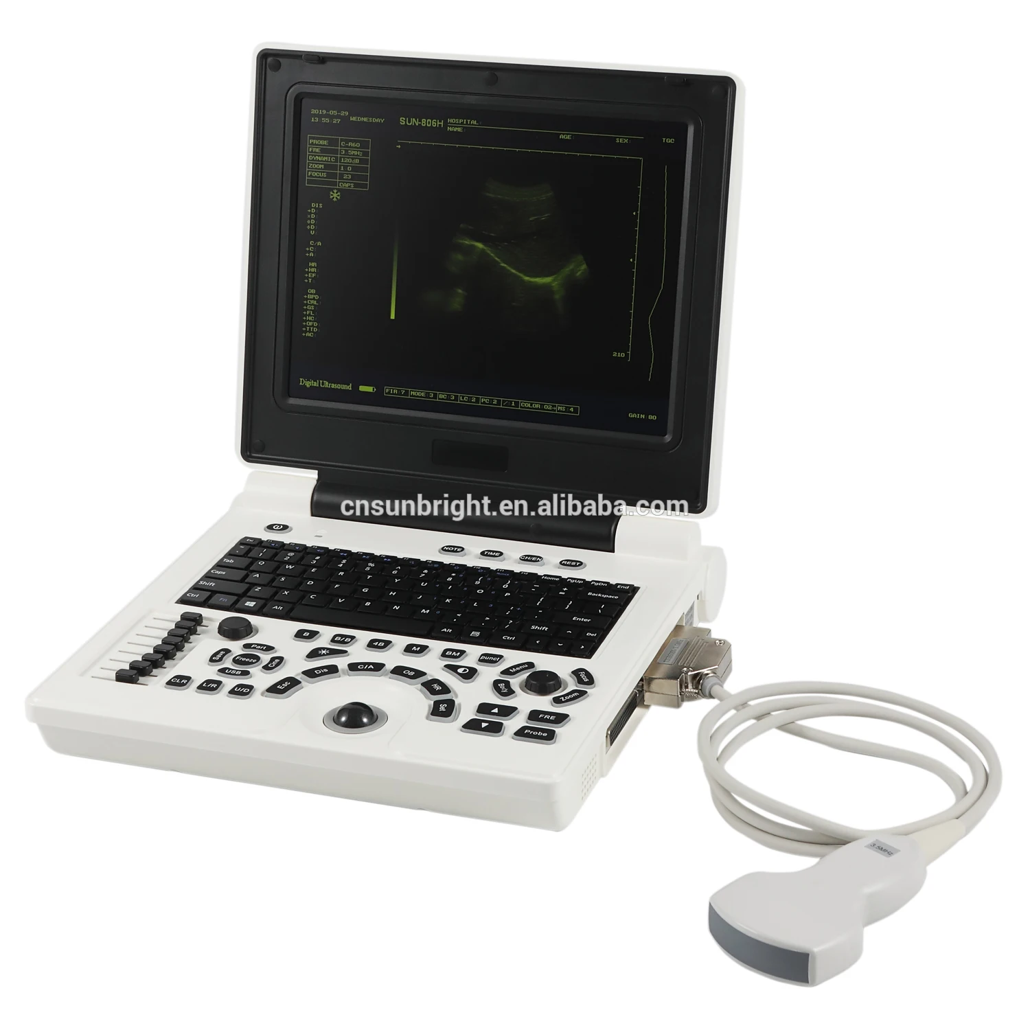 CE Portable mindray color doppler ultrasound ecografo mindray m5 m7 m9 devices ultrasound portable with low price
CE Portable mindray color doppler ultrasound ecografo mindray m5 m7 m9 devices ultrasound portable with low price
